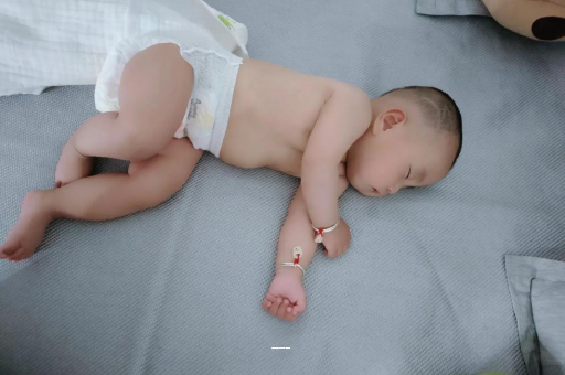 福州宝宝上火有眼屎